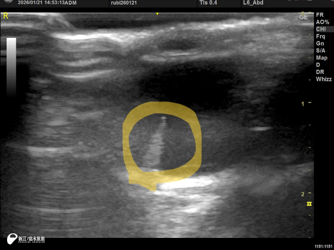 フンボルトペンギンのペクテン 超音波診断による画像